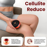 Smart Dynamic Cupping Therapy Set with Red Light